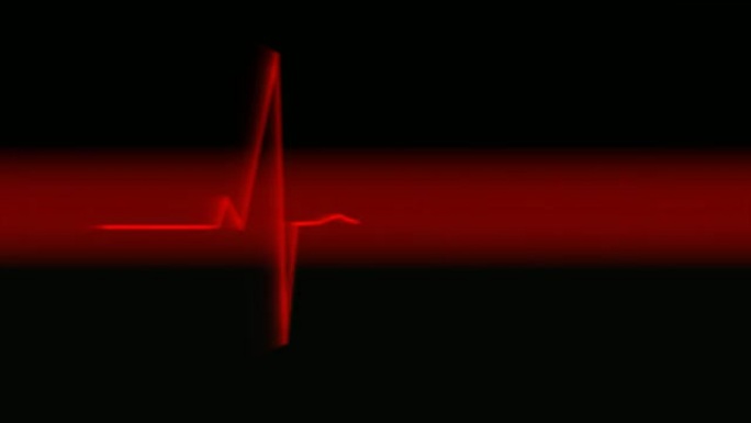 心脏监测仪心脏监测仪心电图
