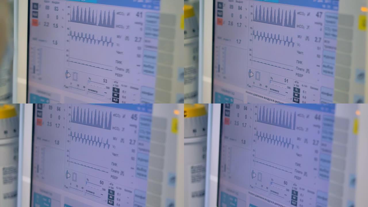 显示患者来自医疗呼吸机的数据的屏幕。