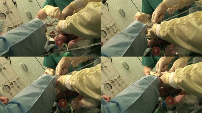 （HD1080i）分娩：切割新生儿脐带