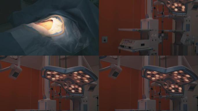 手术室的灯点亮，向上倾斜