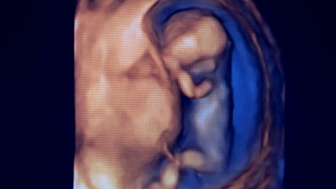 母亲子宫中微小的人类胎儿的图像