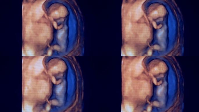母亲子宫中微小的人类胎儿的图像