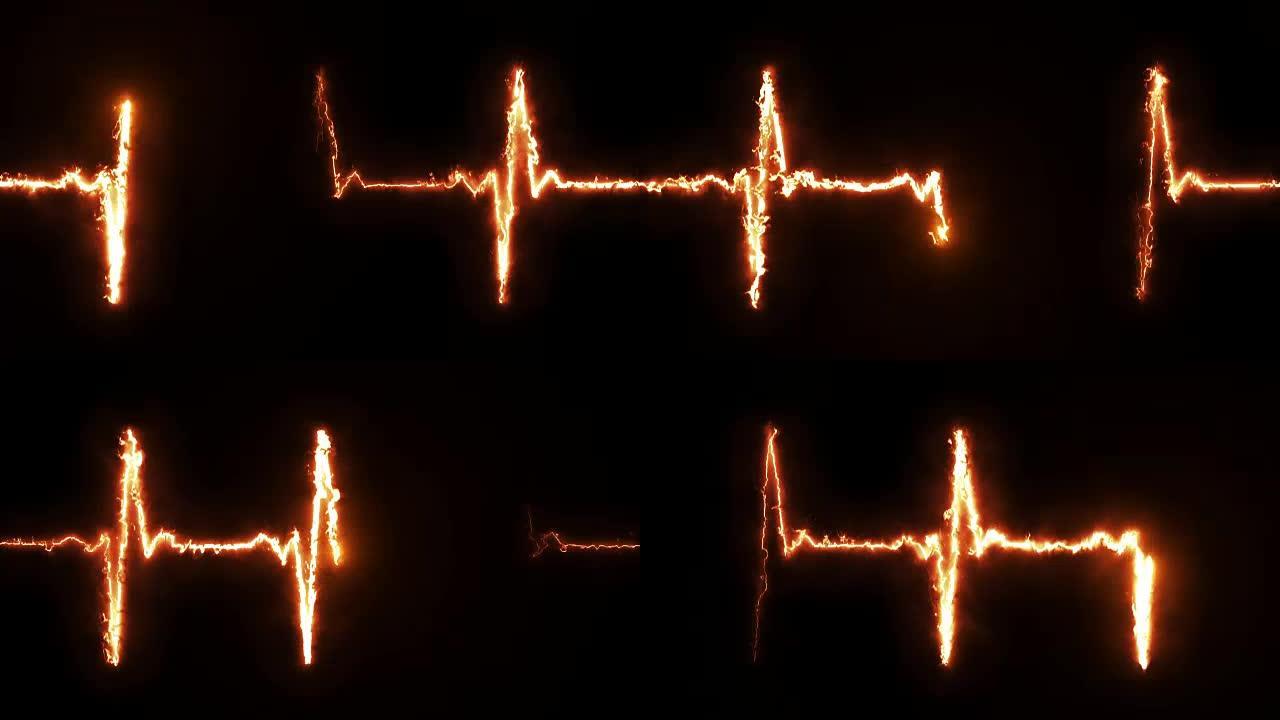 燃烧脉搏心脏线监护仪