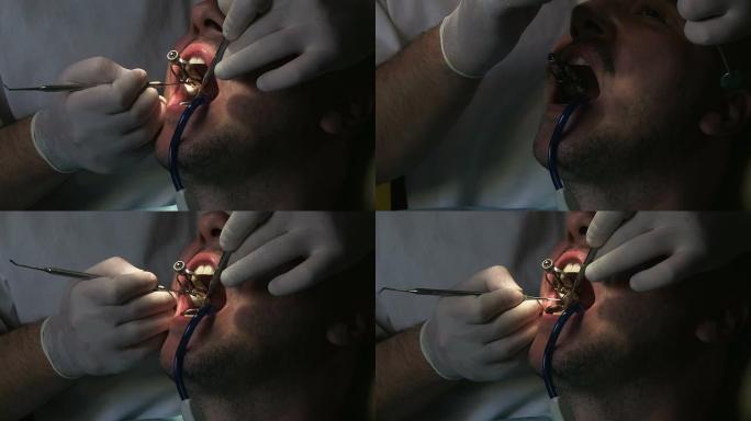 牙医在工作牙科医生医院拔牙种牙洗牙