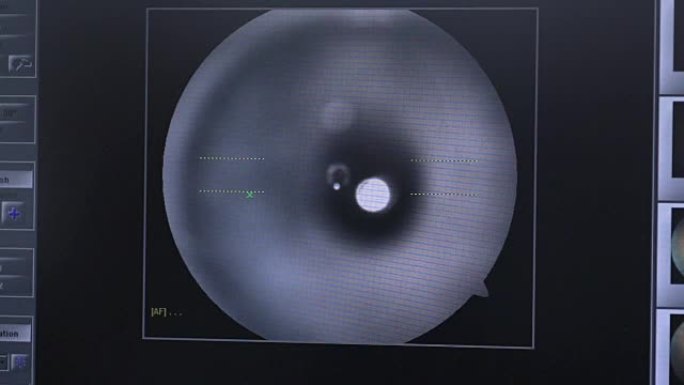 现代自动机器检查眼球。专业医疗设备屏幕上的眼科检查测试