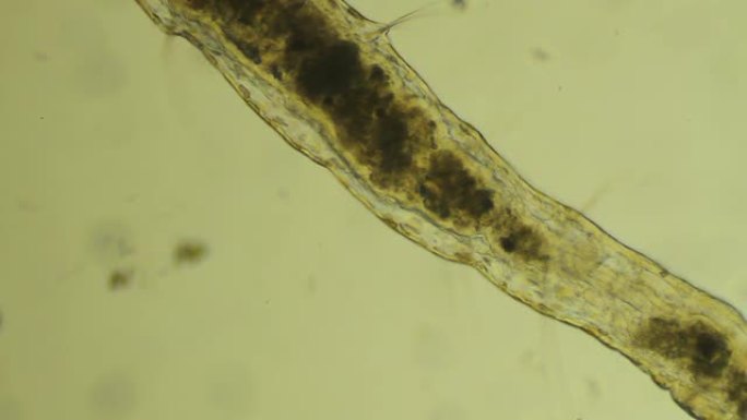 微小蠕虫Aelosomna爬行