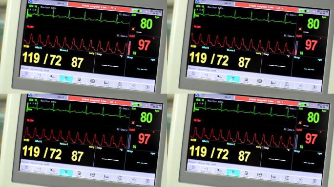 生命体征监测仪生命体征监测仪心电图死亡急