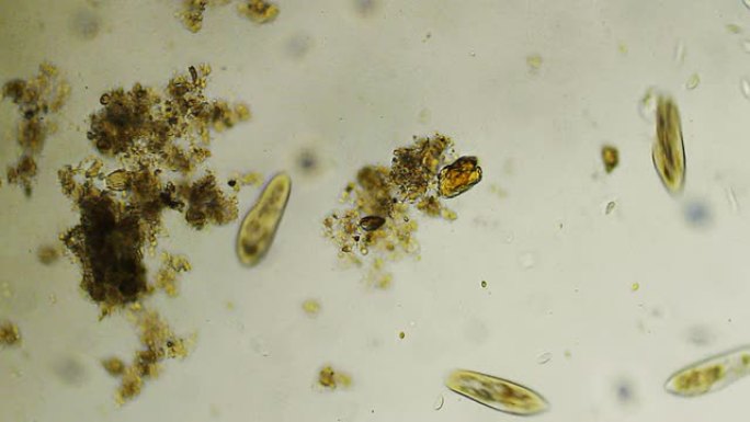 草履虫尾群微生物观察在显微镜下的虫子