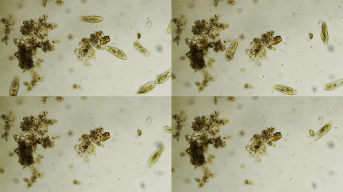草履虫尾群微生物观察在显微镜下的虫子