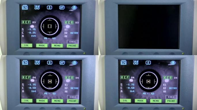现代自动机器检查眼球。专业医疗设备屏幕上的眼科检查测试