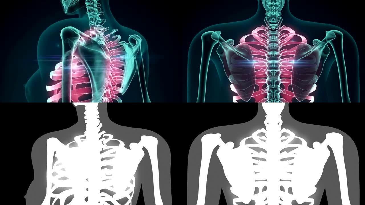 疼痛的肋骨的3d渲染插图。医学概念动画。
