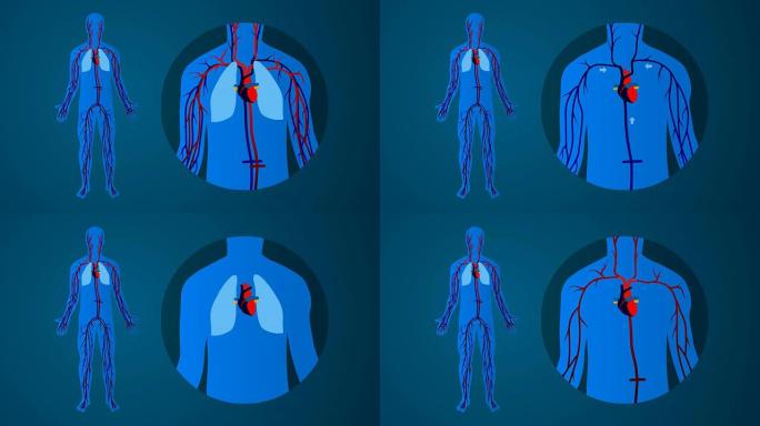 人体心血管循环系统：蓝色背景