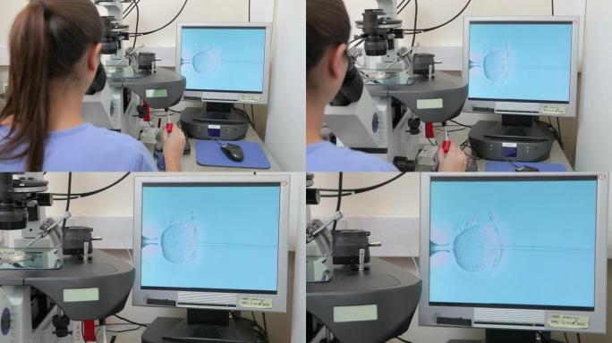 试管婴儿治疗中卵子的实验室受精