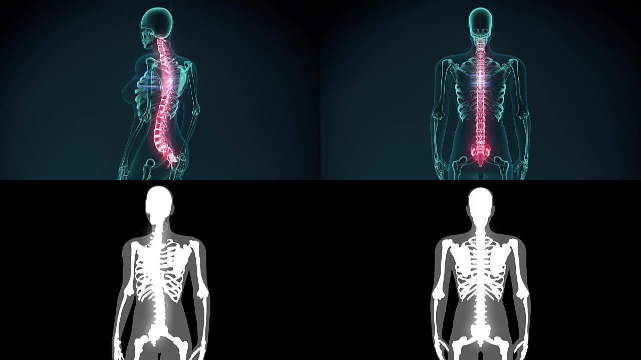 痛苦的椎骨的3d渲染插图。医学概念动画。