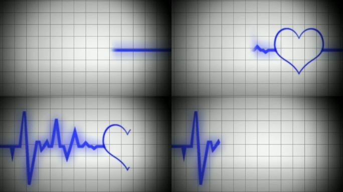心电图V3型心脏监测仪