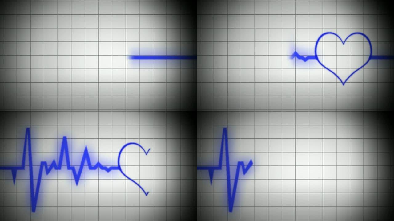 心电图V3型心脏监测仪