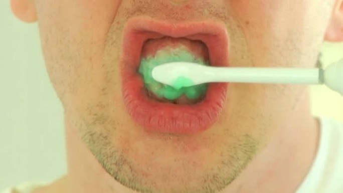 电动牙刷（HD）保护牙齿口腔卫生毛刷