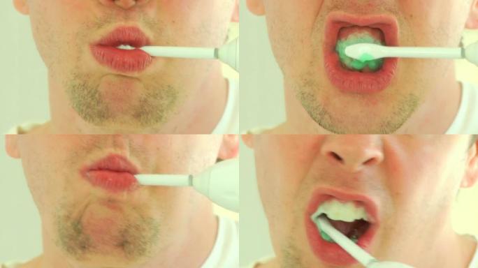 电动牙刷（HD）保护牙齿口腔卫生毛刷