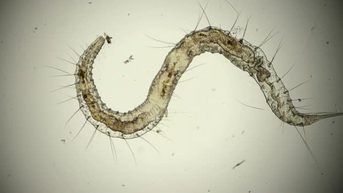环节蠕虫，普里什蒂纳种，显微照片