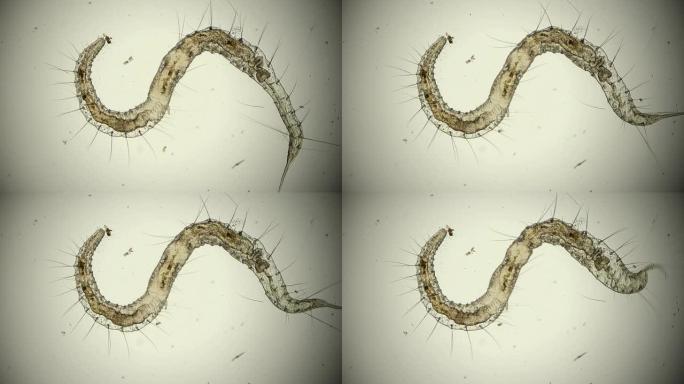 环节蠕虫，普里什蒂纳种，显微照片