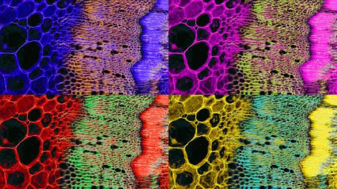 大豆茎显微图-植物组织变色