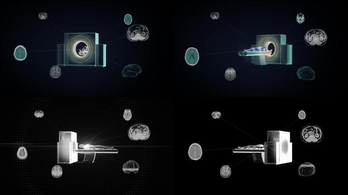 X射线CT扫描仪，医学MRI