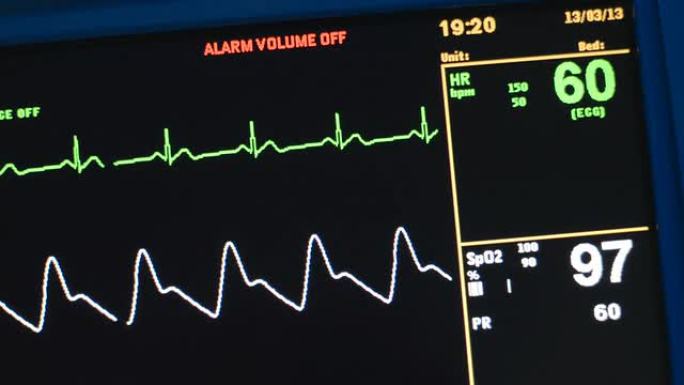 生命体征监测仪心电图心率心脏死亡生命体征