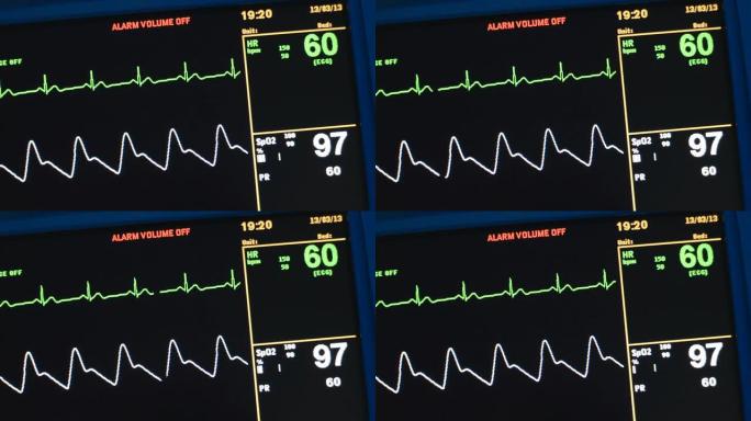 生命体征监测仪心电图心率心脏死亡生命体征