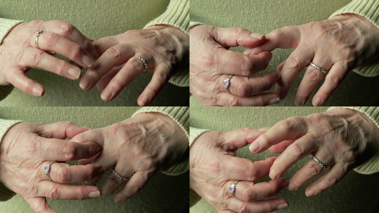 关节炎手，特写老年人手指关节褶皱