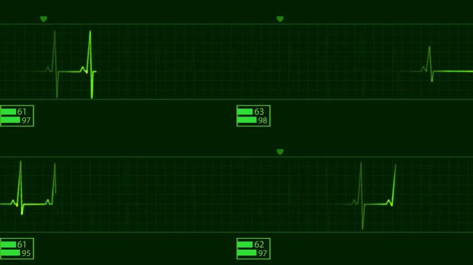 心电图脉冲描记心脏监测仪