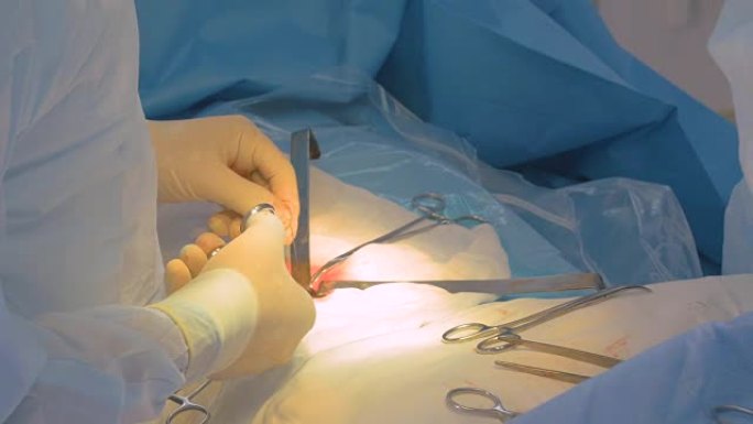 外科医生用手术器械操作。