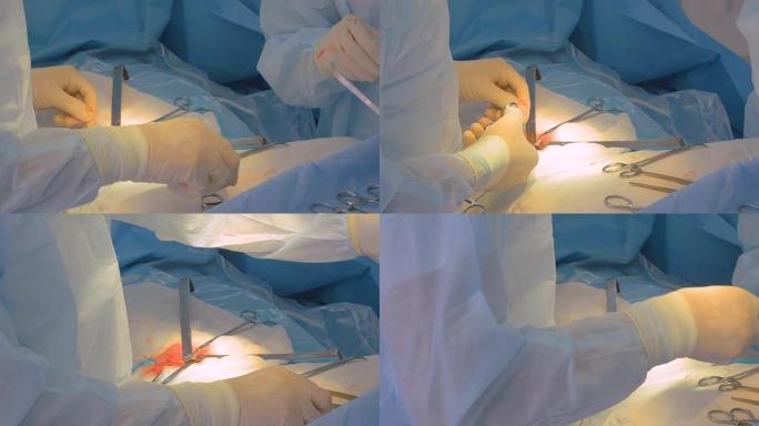 外科医生用手术器械操作。