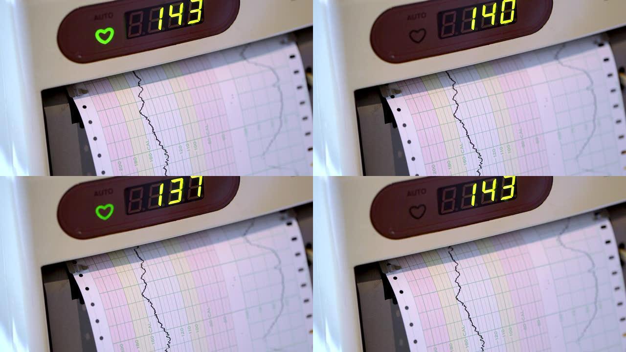 高清：心率监测器（视频）