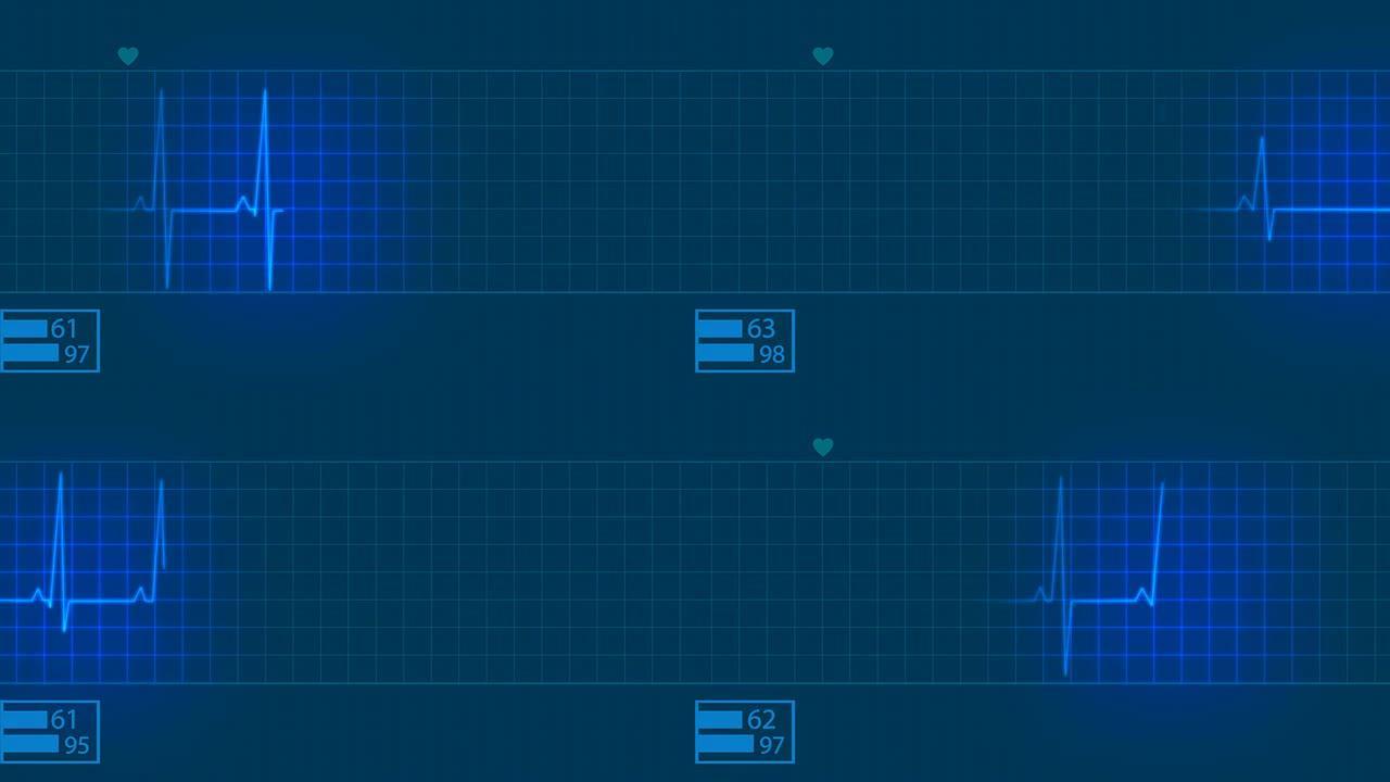 心电图脉冲描记心脏监测仪
