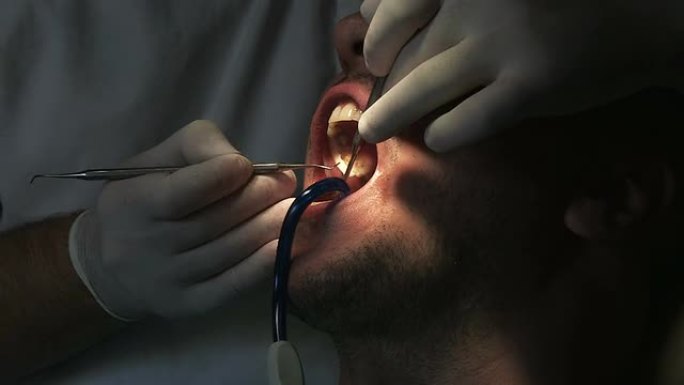 牙医在工作医院仪器手术室牙科手术种植