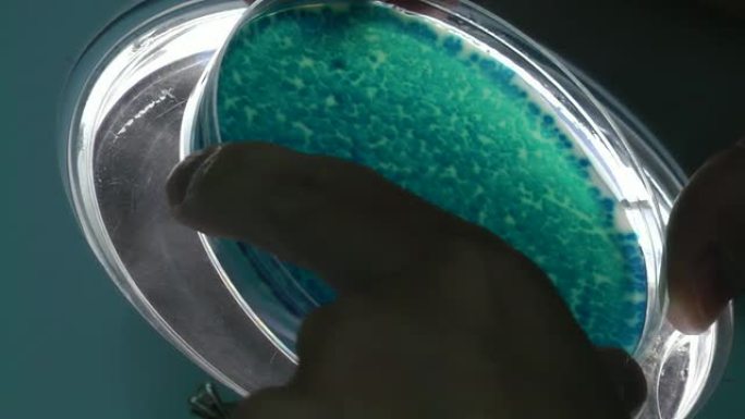 蓝色噬菌体斑块蓝色噬菌体斑块