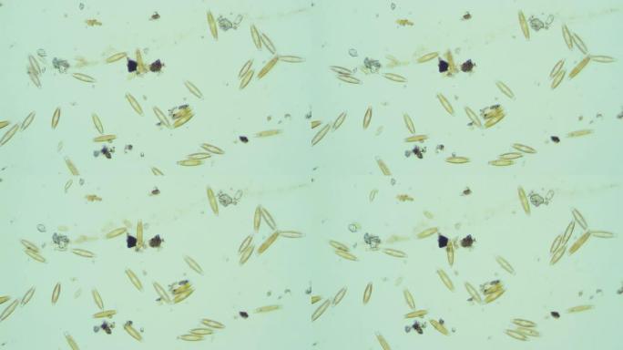 污水中的微生物污水中的微生物