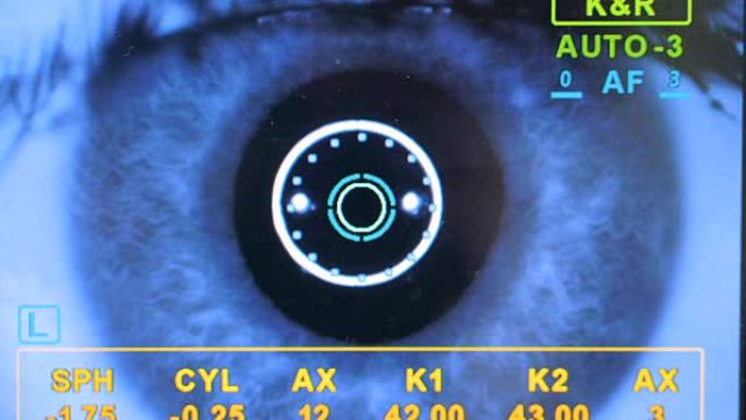 显示眼睛检查进展的数据屏幕。