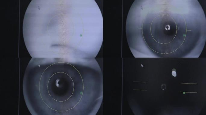 视力检查时用眼睛在屏幕上显示医疗现代化设备。特写