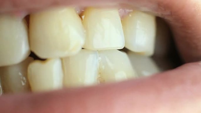 人类牙齿人类牙齿