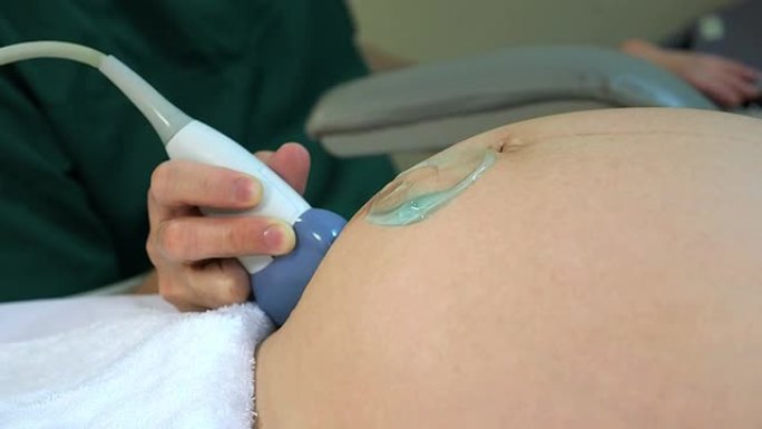 妊娠39周的产前超声检查