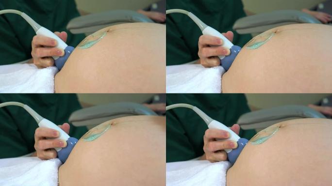 妊娠39周的产前超声检查