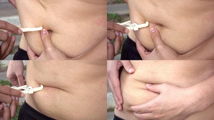 男人用腹部的皮肤折叠卡尺测量身体脂肪百分比