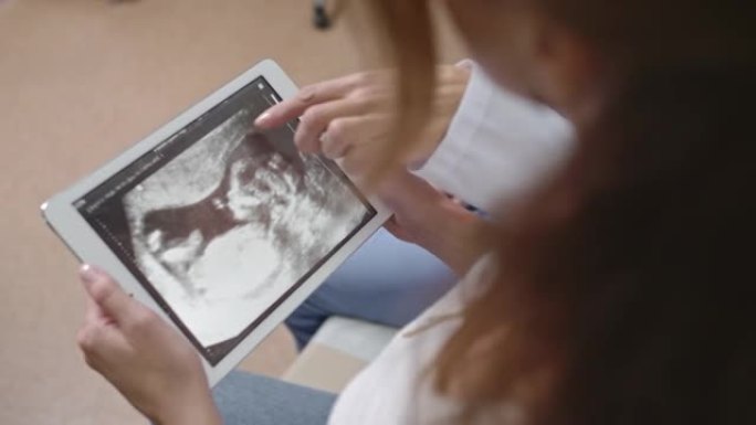女人在平板电脑上看着超声波扫描图片