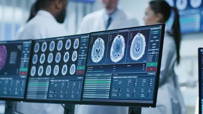 计算机屏幕显示MRI，大脑的CT图像扫描。在脑研究实验室的医学科学家团队的背景会议中。神经科医生/神