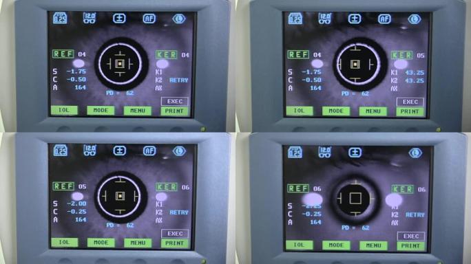 医疗现代设备在眼睛检查时屏幕上显示