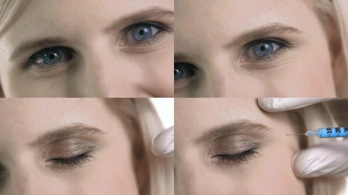 高清: 眉毛肉毒杆菌