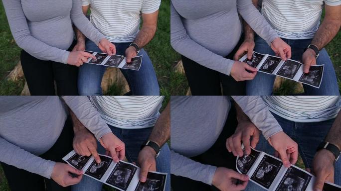 产前婴儿照片特写镜头四维彩超准妈妈