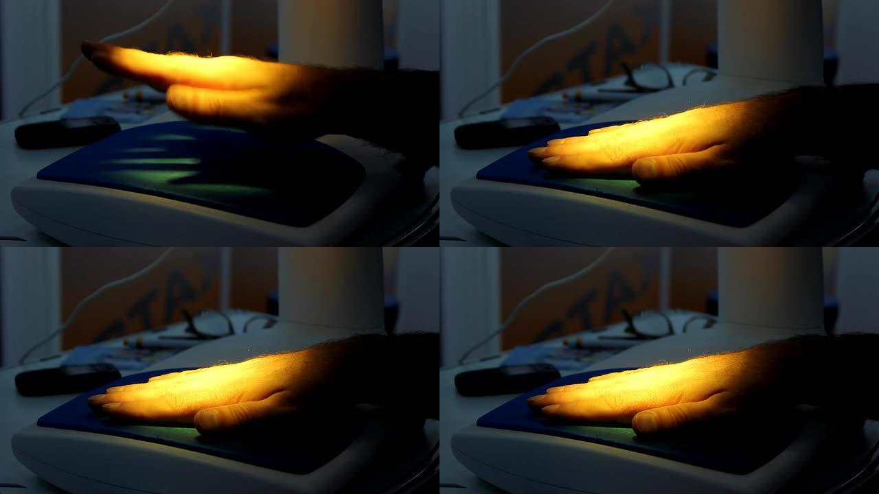 光疗（HD）光疗手掌治疗