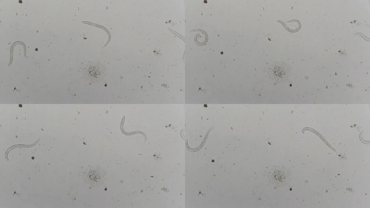 寄生虫：斯特氏拟杆菌